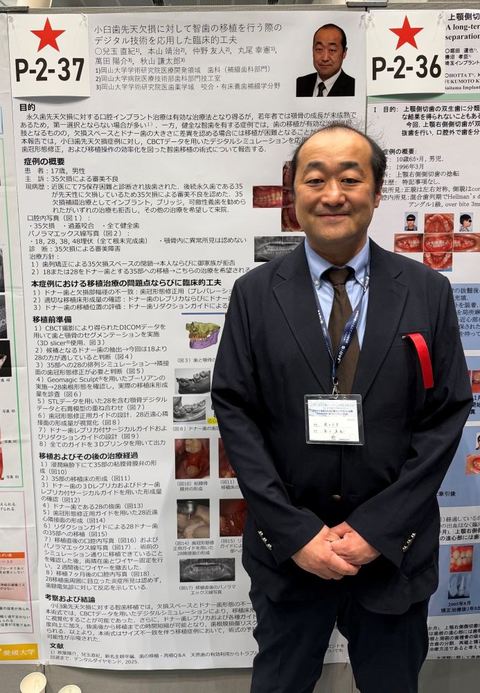 兒玉先生がポスター発表